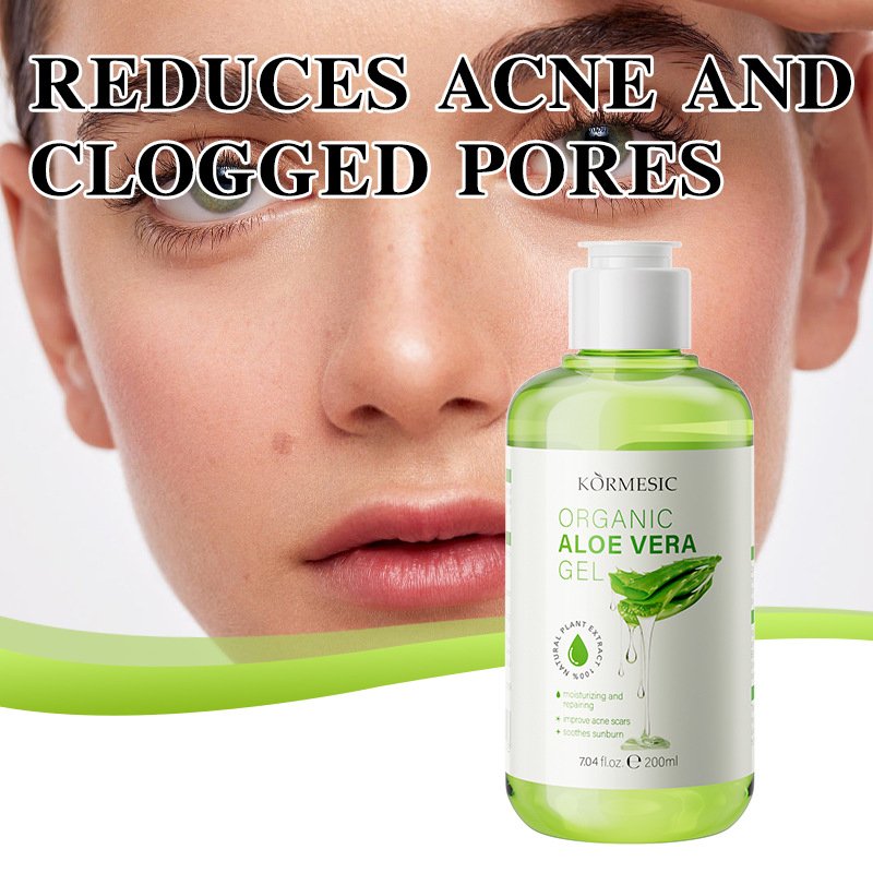 KORMESIC Organic Aloe Vera Gel 200ml Soothing & Repairing Hydrating Body Lotion After Sun Care Face Gel Wholesale & OEM - Image 5